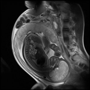 Рентген при беременности: возможные последствия