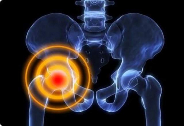 Боль в тазобедренном суставе — причины, симптомы и лечение