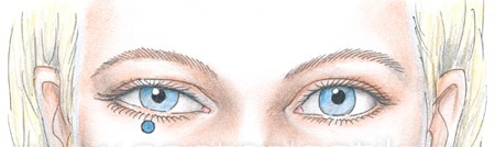 Асимметрия глаз — причины, как исправить
