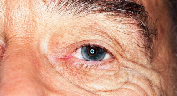 Отмирает сетчатка глаза у пожилого человека — что делать?