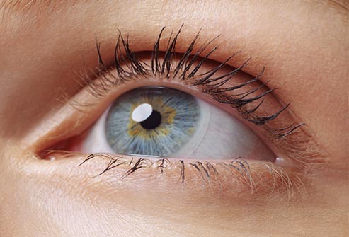 Темные круги под глазами у женщин: причины и эффективные способы лечения