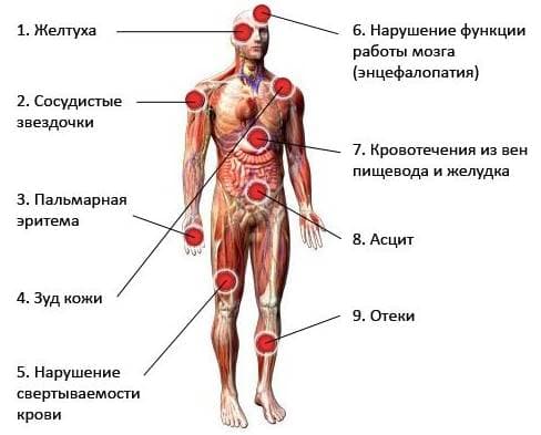 Оказание первой помощи при попадании дез. на кожу и слизистые.